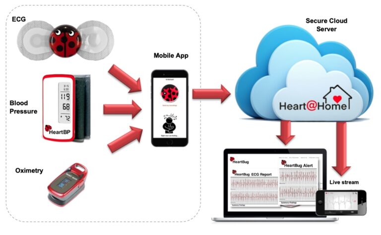 Welcome to Heart@Home – HeartBug